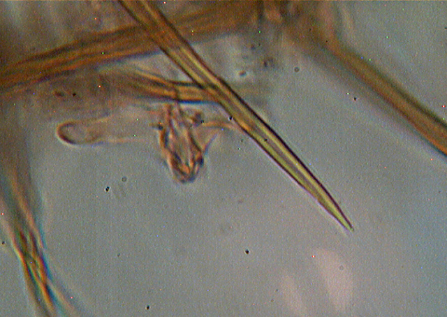 Asterostroma laxum Bres. (1920)